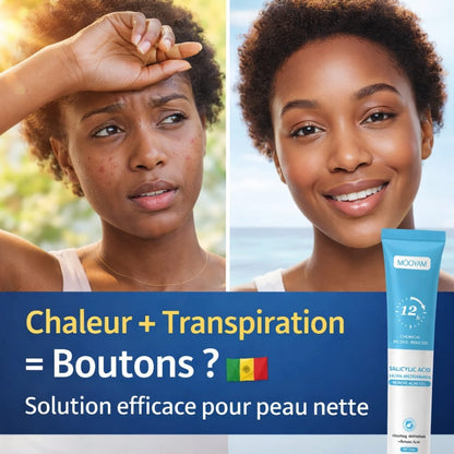 Gel à l’Acide Salicylique – Soin Anti-Acné et Peau Claire